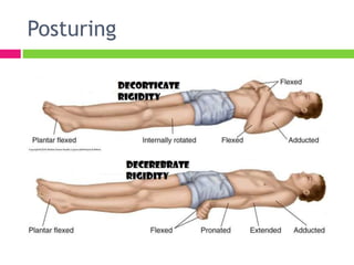 Approach to the Comatose patient | PPTX
