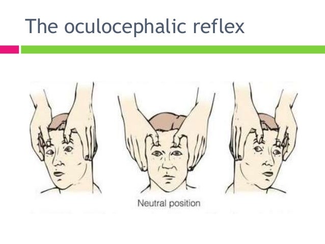 Approach To The Comatose Patient Approach To The Comatose Patient