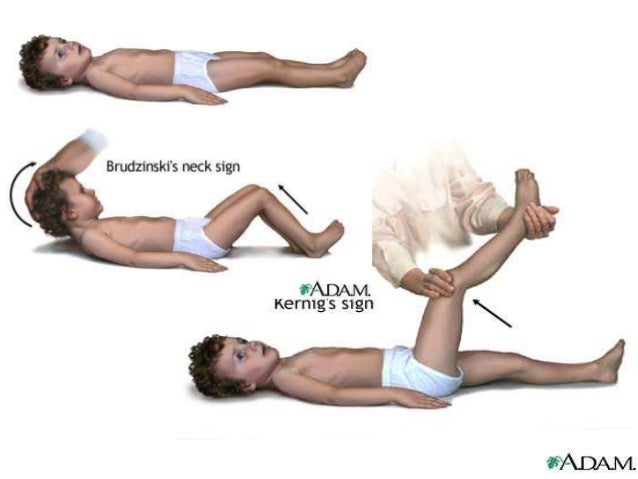 Approach To The Comatose Patient Approach To The Comatose Patient