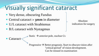 An approach to congenital cataract genetic based | PPTX