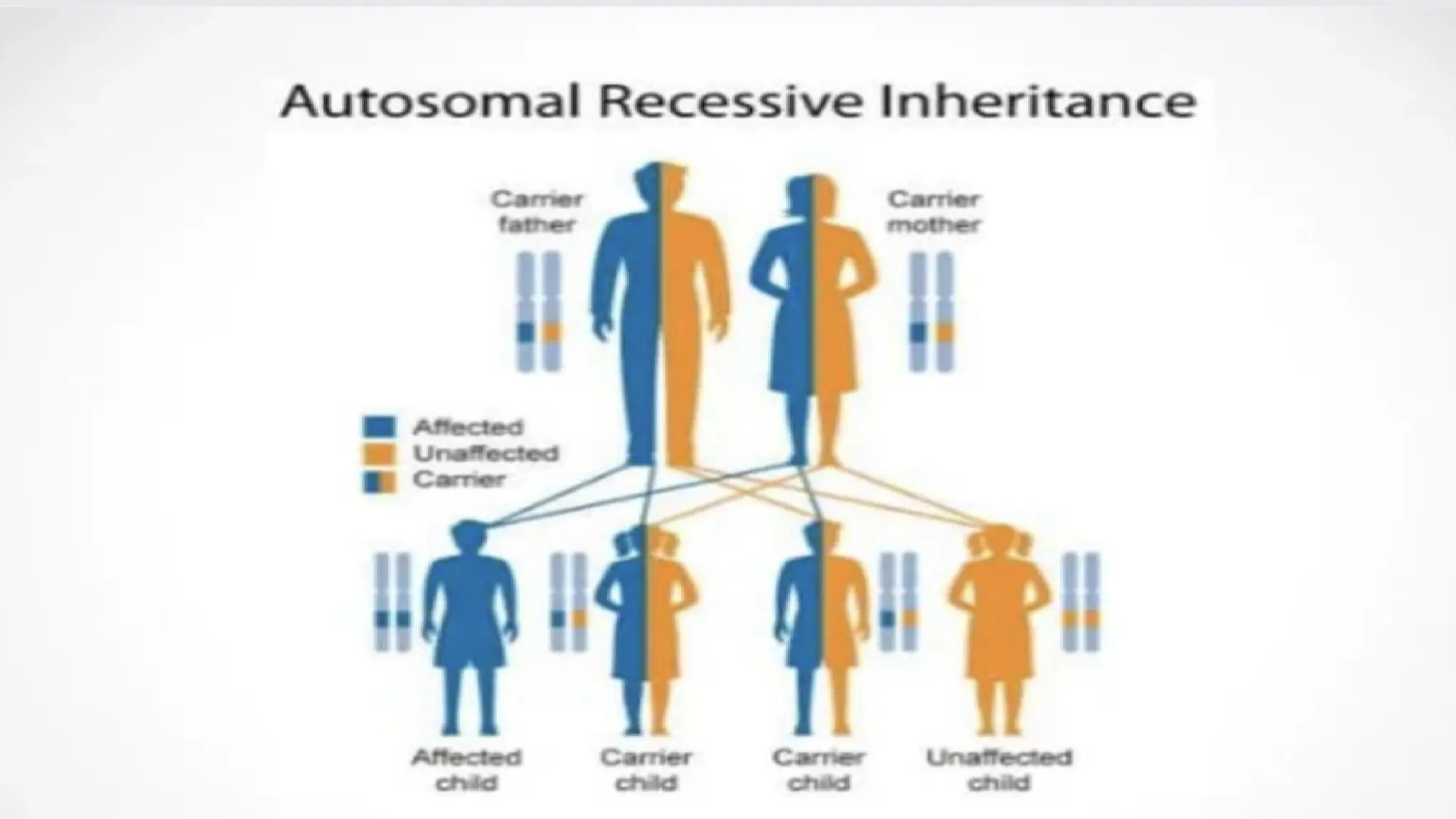 Approach to congenital nephrotic syndrome in child Samreena abid G18.pptx