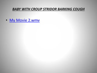 BABY WITH CROUP STRIDOR BARKING COUGH
• My Movie 2.wmv
 