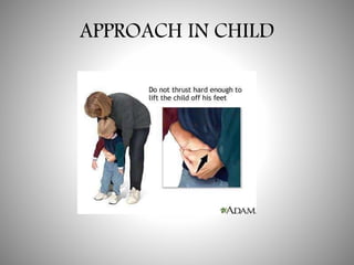 APPROACH IN CHILD
 