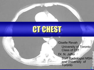 CT CHEST
      Giselle Revah
        University of Toronto
        Class of 0T7
      Dr. N. Jaffer
        Staff Radiologist MSH
        and University of
        Toronto
 