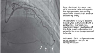 large, dominant, tortuous, trans
pical epicardial collateral supplies
the right posterior descending
artery from the distal left anterior
descending artery.
This collateral is likely to become
kinked when instrumented with a
guidewire or microcatheter,
resulting in loss of visualization of
the distal target and creating the
potential for acute intraprocedural
ischemia.
Collaterals of this configuration are
rarely helpful as conduits for
retrograde access.
 