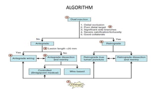 ALGORITHM
 