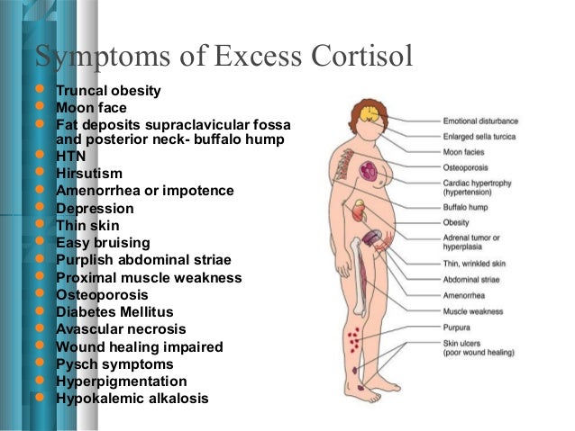 cushing cortisol cushings hump obesity truncal pseudo dexamethasone