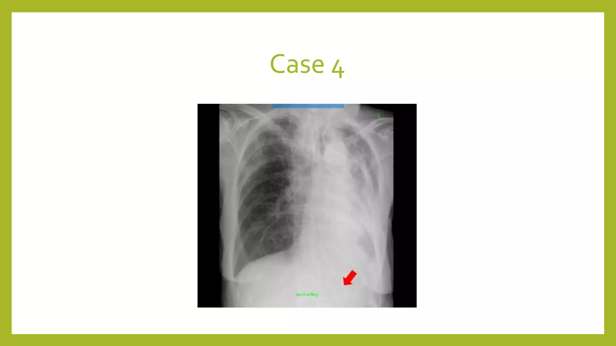 Case 4
 