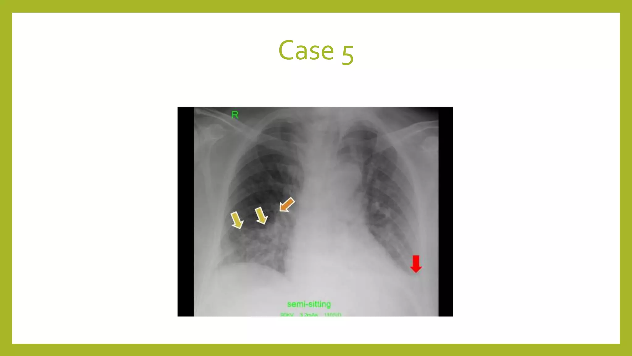 Case 5
 