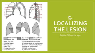 Approach to cxr | PPTX