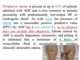 Peripheral edema is present in up to 65% of patients
admitted with AHF and is less common in patients
presenting with predominantly low-output HF or
cardiogenic shock. As with rales, the presence of
edema has a reasonable positive predictive value
(PPV) for AHF but a low sensitivity, so its absence
does not exclude that diagnosis. Edema caused by
AHF is usually dependent, symmetric, and pitting. It
is estimated that a minimum of 4 liters of
extracellular fluid is accumulated to produce
clinically detectable edema.
 