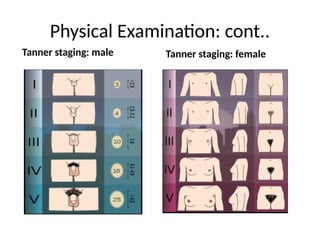 Physical Examination: cont..
Tanner staging: male Tanner staging: female
 