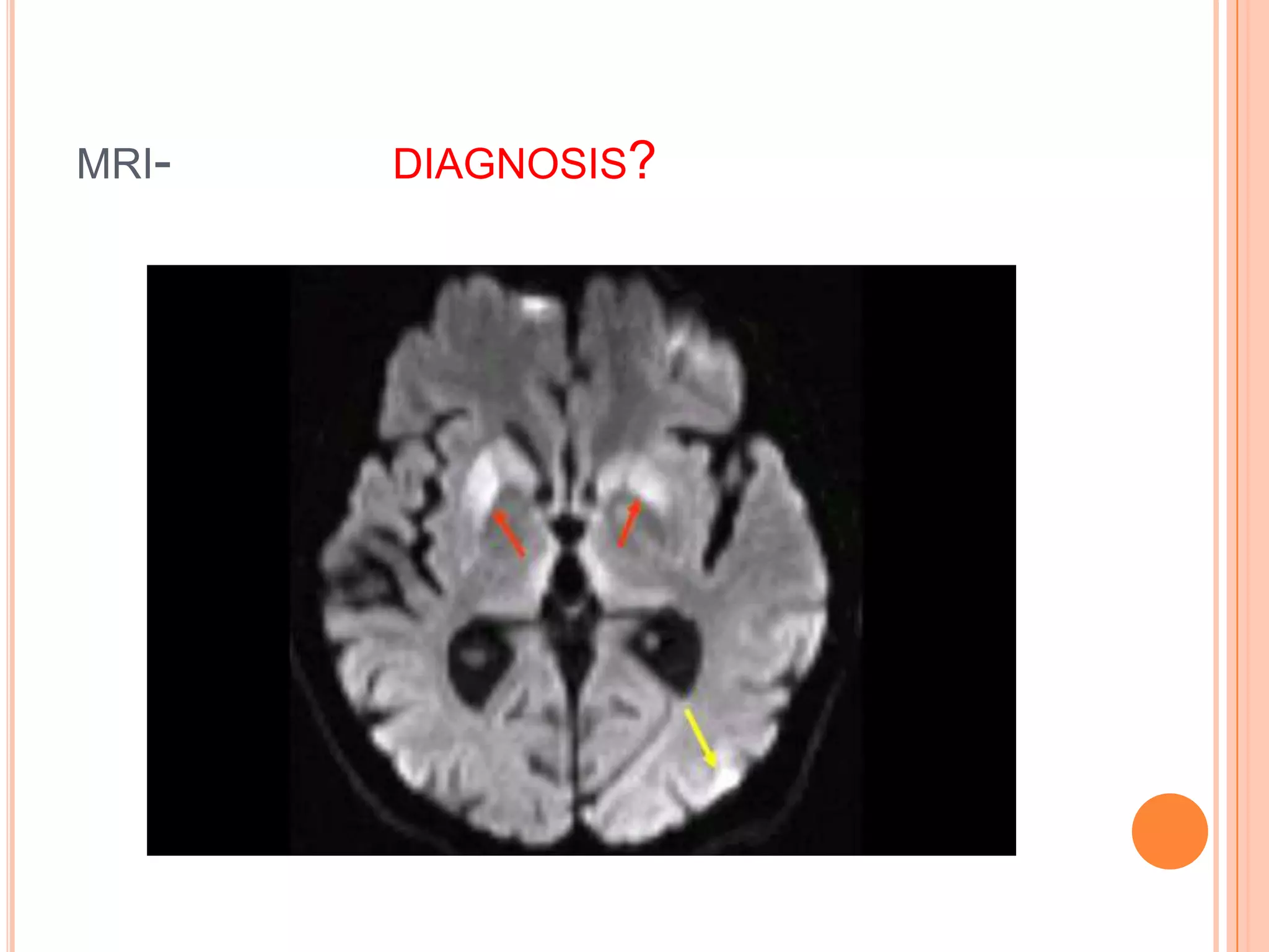 MRI- DIAGNOSIS?
 