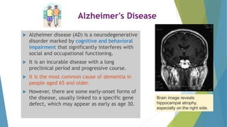 Approach to dementia and alzheimers s | PPTX
