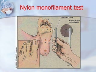 Nylon monofilament test 
 