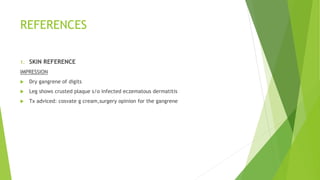 REFERENCES
1. SKIN REFERENCE
IMPRESSION
 Dry gangrene of digits
 Leg shows crusted plaque s/o infected eczematous dermatitis
 Tx adviced: cosvate g cream,surgery opinion for the gangrene
 