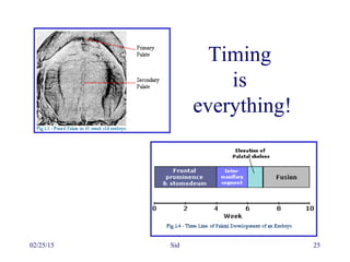 02/25/15 Sid 25
Timing
is
everything!
 