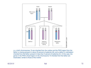 02/25/15 Sid 72
(A); A) both chromosomes 15 are inherited from the mother and the PWS region from the
father is missing (present in about 25 percent of patients) (B); and a defect in methylation
inherited from the father (present in less than 5 percent of patients) (C). In this case, the
genes in the PWS critical region on the chromosome 15 inherited from the father are
inactivated, similar to those of the mother
 