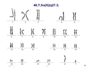 02/25/15 Sid 82
46,Y,fra(X)(q27.3)
 