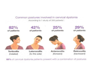 Approach to dystonia | PPTX