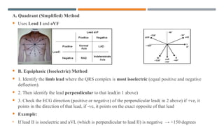 Comprehensive Approach to Electrocardiography (ECG) Review | PPTX