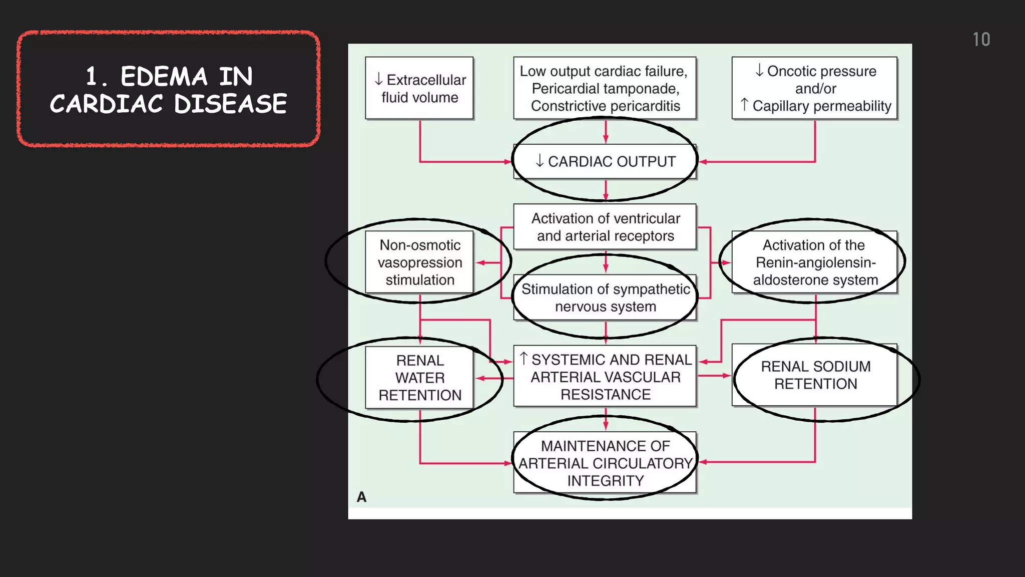 10
1. EDEMA IN
CARDIAC DISEASE
 