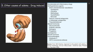 5. Other causes of edema - Drug induced
19
 