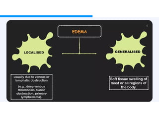 Led Edema Approach APPROACH TO EDEMA ppt.MANAGEMENT IN PATIENT | PPTX