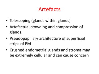 Artefacts
• Telescoping (glands within glands)
• Artefactual crowding and compression of
glands
• Pseudopapillary architec...