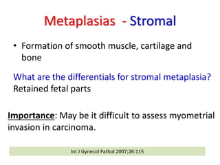 Metaplasias - Stromal
Endometrial stromal nodule with smooth muscle metaplasia
 