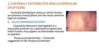 Photo Distributed Rash APPROACH TO FEVER WITH RASHES.pptx