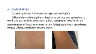 APPROACH TO FEVER WITH RASHES.pptx