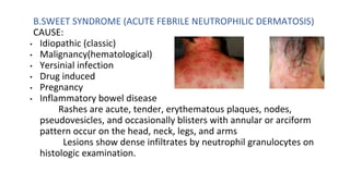 Dense Vs Diffuse Rash APPROACH TO FEVER WITH RASHES.pptx