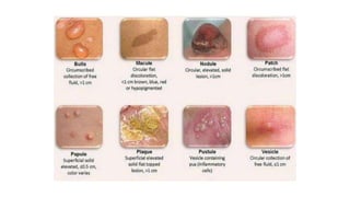 Herman S Rash APPROACH TO FEVER WITH RASHES.pptx