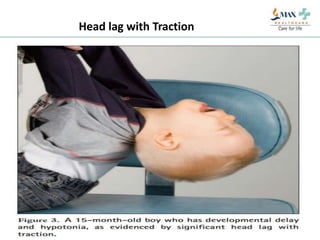 Approach to floppy infant | PPTX