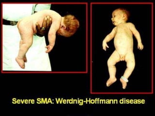 Neurology Chapter of IAP
 