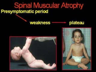 Neurology Chapter of IAP
 