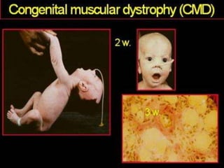 Neurology Chapter of IAP
 