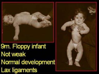 Neurology Chapter of IAP
 