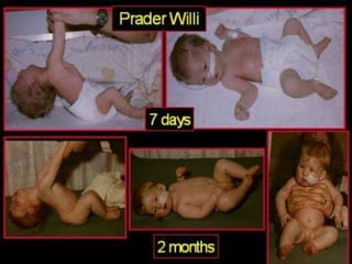 Neurology Chapter of IAP
 