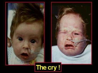 Neurology Chapter of IAP
 