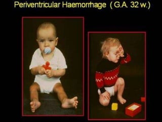 Neurology Chapter of IAP
 