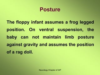 Neurology Chapter of IAP
Posture
The floppy infant assumes a frog legged
position. On ventral suspension, the
baby can not maintain limb posture
against gravity and assumes the position
of a rag doll.
 