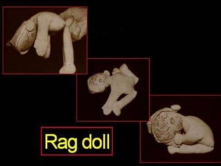 Neurology Chapter of IAP
 