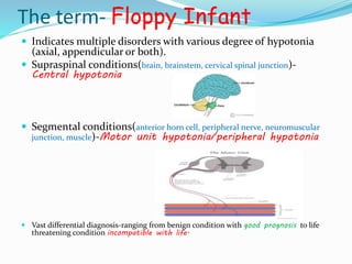 Approach_to_floppy_infant__1_.pptx