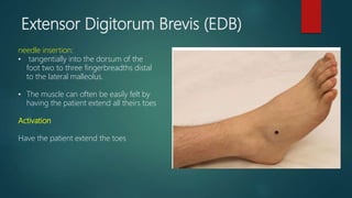 Two Fingerbreadths foot drop | PPTX
