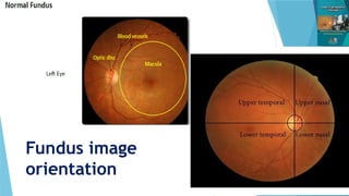 Approach to fundus camera- Reading and interpretation 2.pptx