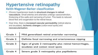 Approach to fundus camera- Reading and interpretation 2.pptx