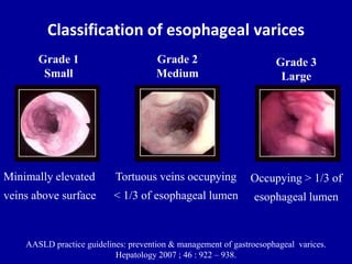 Jsph Varices Classification Approach to gastrointestinal bleeding | PPTX