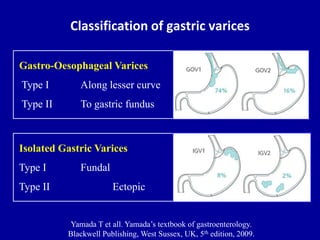 Jsph Varices Classification Approach to gastrointestinal bleeding | PPTX